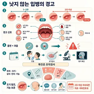 2주 이상 낫지 않는 입병의 경고 신호와 구강암 진단 과정을 설명한 인포그래픽